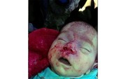 شهادت یک نوزاد در حملات تکفیری‌ها