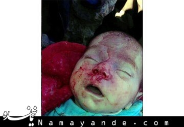 شهادت یک نوزاد در حملات تکفیری‌ها