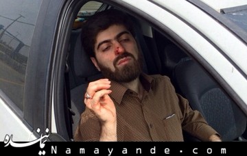 ضرب و شتم یک استاد دانشگاه توسط رئیس دانشگاه علامه! +عکس و سند علوی