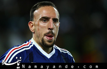 فرانک ریبری جام جهانی را از دست داد
 فرانک ریبری