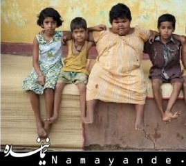 دختری 5 ساله با وزن 75 کیلو و اشتهایی نامحدود!! +عکس دختر