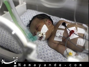 علت مرگ ۹ نوزاد در بیمارستان امام نوزاد