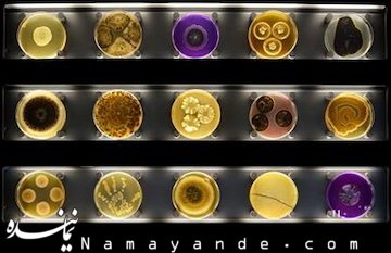 بهجای پاندا ویروس ابولا را از نزدیک ببینید! ابولا