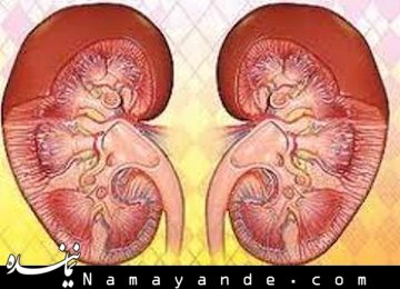 قاتلان کلیه را بشناسید کلیه