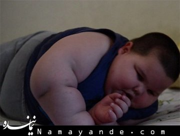 چاق ترین کودک جهان