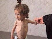 گرسنگان مردم جنوب دمشق