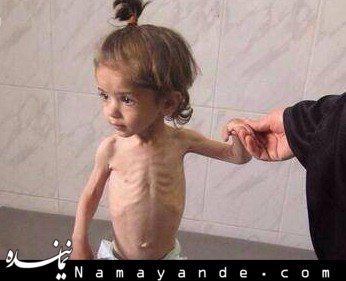 عکس هایی تاسف بار از گرسنگان ساکنان جنوب دمشق گرسنگان مردم جنوب دمشق