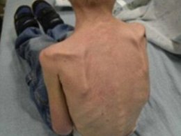 تنبیه وحشیانه پسر ۹ ساله با شلاق! +تصاویر (۱۴+)  شکنجه کودک 43