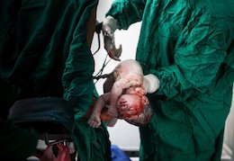 زایمان ناگهانی بدون اطلاع از باردار ی!+تصاویر  تولد نوزاد 43