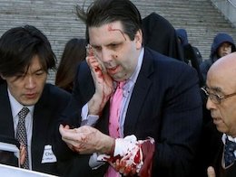 ۸۰ بخیه روی صورت سفیر آمریکا!+تصاویر  حمله به سفیر آمریکا 43