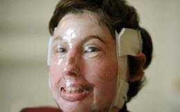 گران ترین لبخند دنیا متعلق به این دختر است! +عکس گران ترین لبخند