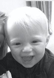 کودکی نوپا با غم انگیزترین بیماری دنیا + تصاویر  کودک