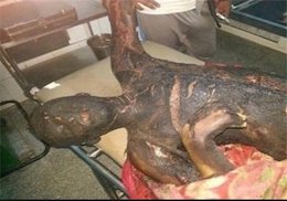 تصاویر/ تکان دهنده از نسل کشی و جنایات هولناک آل سعود در یمن  یمن