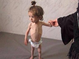 جنایت هولناک داعش علیه فلسطینی ها+تصاویر سوء تغذیه،کودک 43