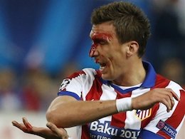 بازی خونین اتلتیکو و رئال مادرید!+تصاویر مصدومیت فوتبالیست 43