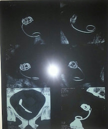 جاماندن شیلنگ ۲۰سانتی دربدن بیمار!+عکس  جاماندن لوله در بدن بیمار