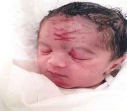 اشتباه وحشتناک یک پزشک!+عکس اشتباه پزشک