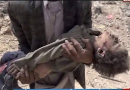 کشتار کودکان یمنی