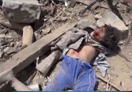 خودکشی خلبان سعودی پس از مشاهده اجساد کودکان یمنی  کشتار کودکان یمنی