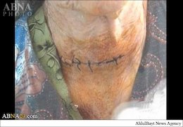 داعش گلوی پیرزن افغان را برید+عکس  جنایت داعش