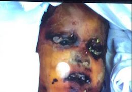 تجاوز و قتل بی رحمانه کودک ۳ ساله+عکس(۱۶+) قتل کودک