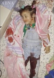 شهادت دختربچه شیعه در حمله تکفیری ها+عکس  شهادت دختربچه شیعه