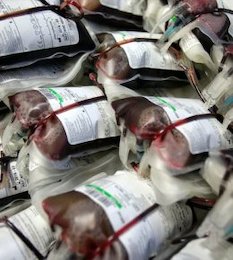 پرونده خون های آلوده؛ از تهران تا پاریس خون/2