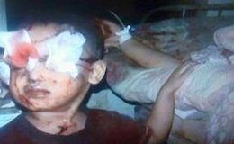 عکسی تکان دهنده از کودک یمنی کودک یمنی