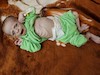 گرسنگی در یمن