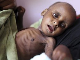 گرسنگی در کمین ۸۰ درصد جمعیت جهان گرسنگی در یمن