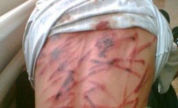 شکنجه دلخراش زندانيان در عربستان+تصاویر(۱۸+) شکنجه دلخراش زندانيان در عربستان