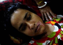 پدر شوهری که در دهان عروسش اسید ریخت!+تصاویر  اسیدپاشی