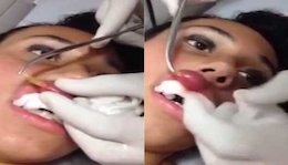 خارج شدن کرم زنده از لب دختر جوان+عکس(۱۶+) خارج شدن کرم زنده از لب دختر جوان