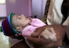 تصاویر دردناک از کودکان جنگ در یمن