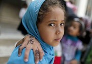 تصاویر دردناک از کودکان جنگ در یمن