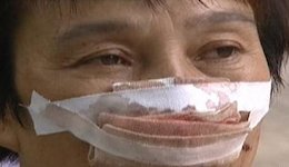 مردی دماغ همسر خود را بلعید!+تصاویر مردی دماغ همسر خود را بلعید