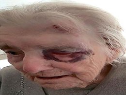 ضرب و شتم وحشیانه در خانه سالمندان+تصاویر  ضرب و شتم وحشیانه در خانه سالمندان