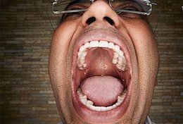 صاحب گشادترین دهان دنیا را بشناسید/عکس 123