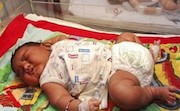 تولد نوزاد چاق