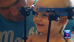 پیوند موفق سر قطعشده یک پسربچه!+عکس  پیوند موفق سر قطعشده یک پسربچه