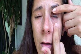 وقتی چسب قطرهای با قطره چشم اشتباه گرفته شود!/عکس  ریختن چسب قطره ای در چشم