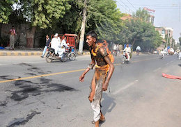 خودسوزی در اعتراض به درآمد کم/عکس خودسوزی