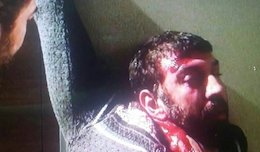 علی انصاریان غرق در خون !/عکس  علی انصاریان