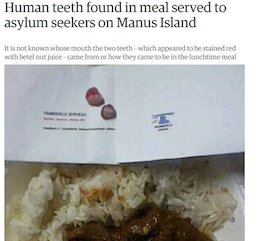 پیداشدن دندان در غذا!/عکس  پیداشدن دندان در غذا