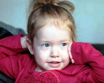 قلب این دختر ۳ بار تعویض شد!/عکس  دختر