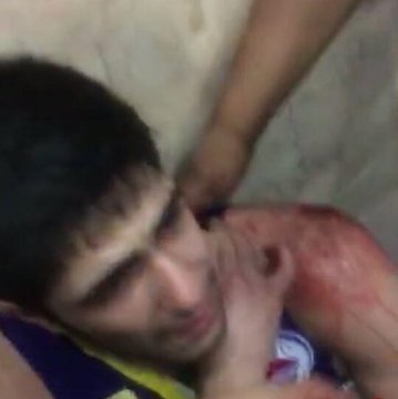 چاقو خوردن ملی پوش ایران/عکس بهنام یخچالی