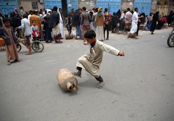 تصاویر دردناک از کودکان جنگ در یمن